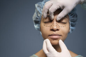 Rhinoplasty Surgery