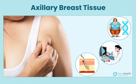 Say Goodbye to Underarm Bulge: Axillary Breast Tissue Explained