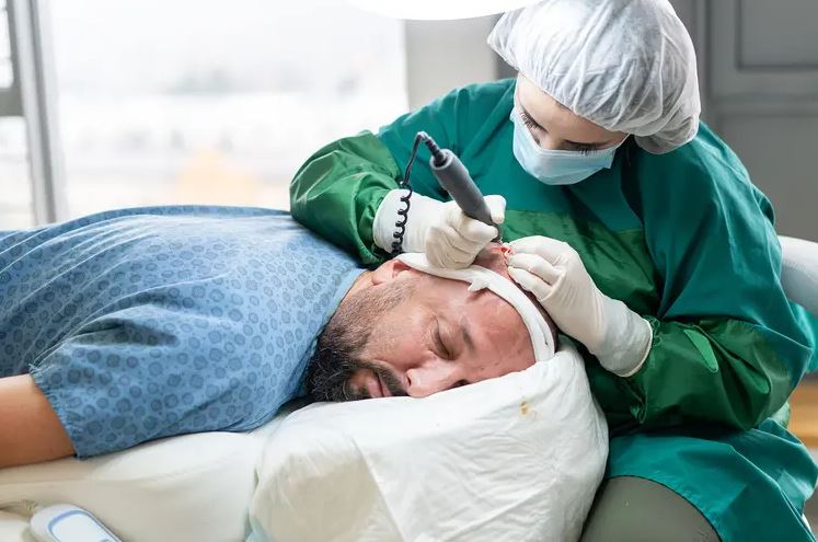 Everything You Need to Know About Hair Transplant: Procedure, Results & Recovery