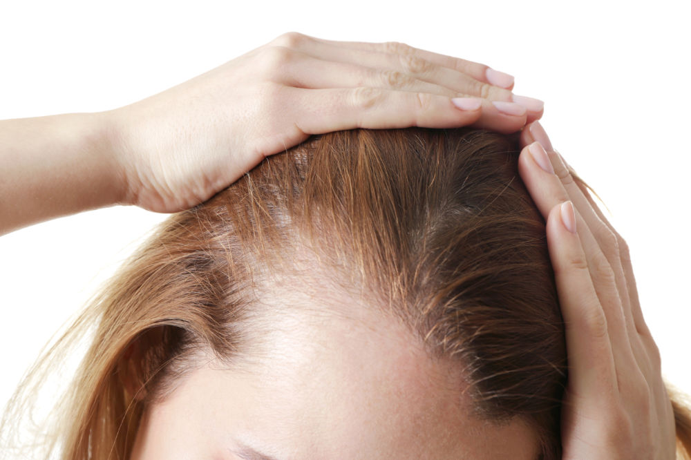 Types of Hair Transplants for Women: FUE vs FUT Explained
