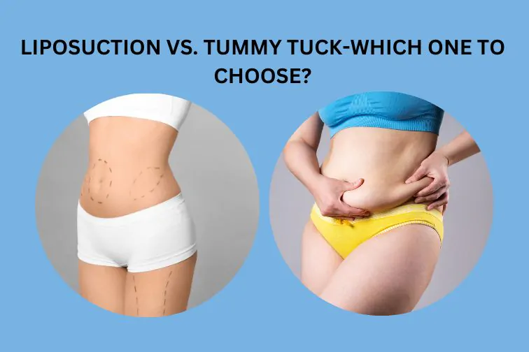 Liposuction vs Tummy Tuck: Which Surgery Do You Really Need?