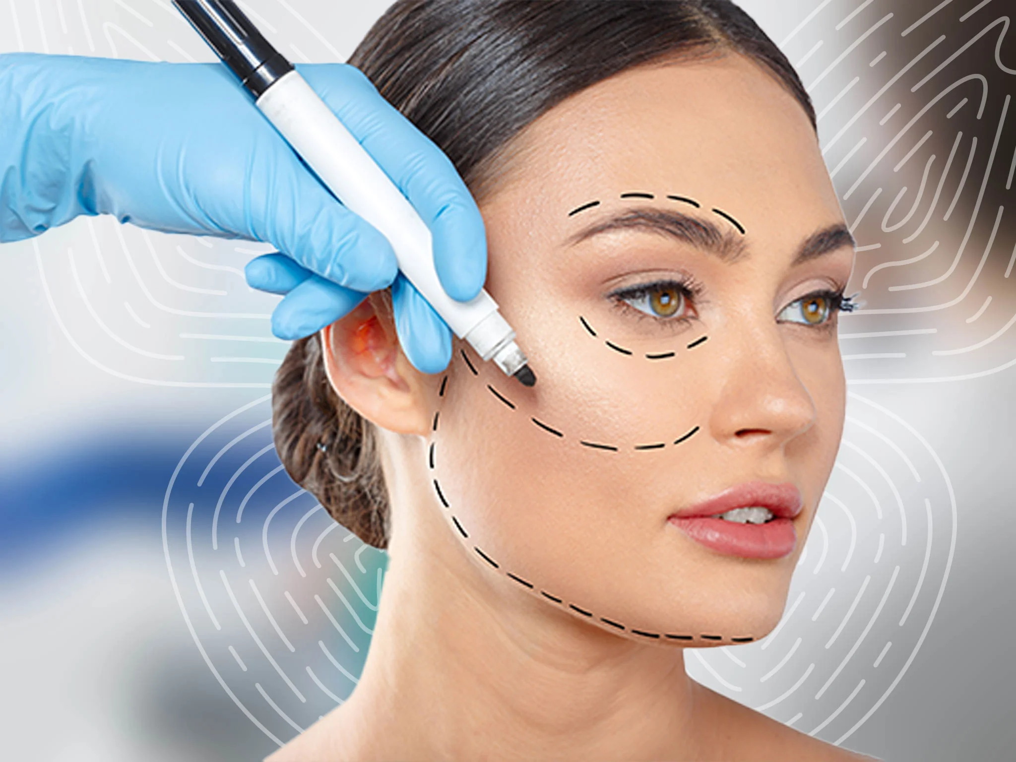 Face Lift Surgery: Complete Guide to Types, Recovery, and Choosing the Best Option