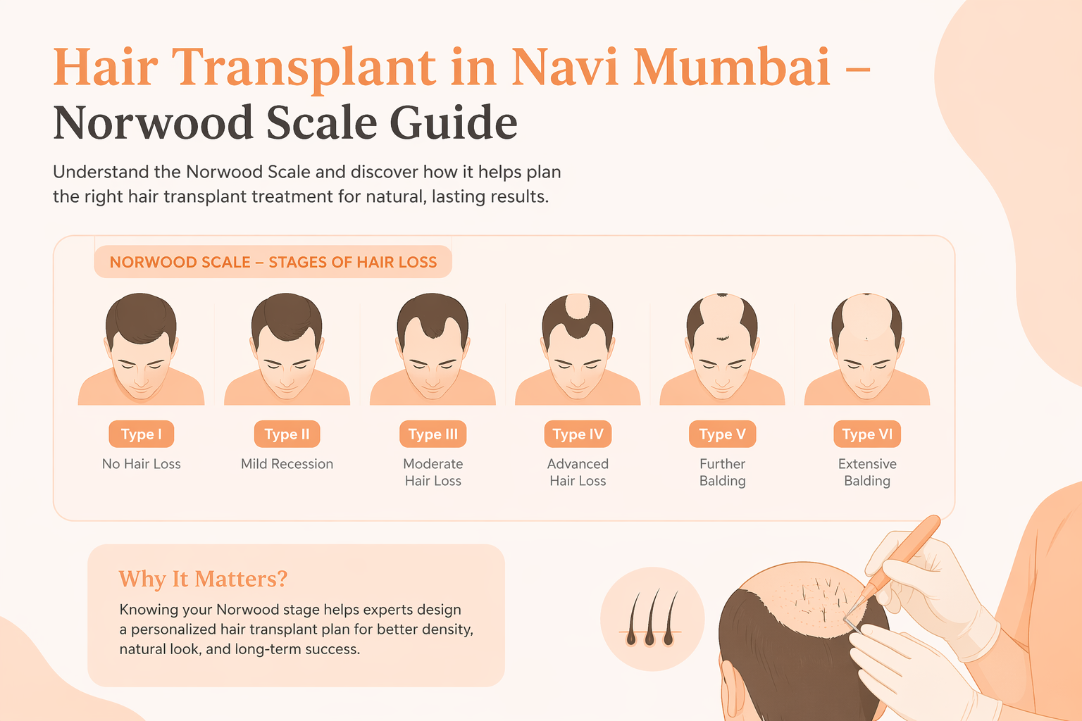Hair Loss Stages Explained: When to Consider a Hair Transplant in Navi Mumbai – Norwood Scale Guide