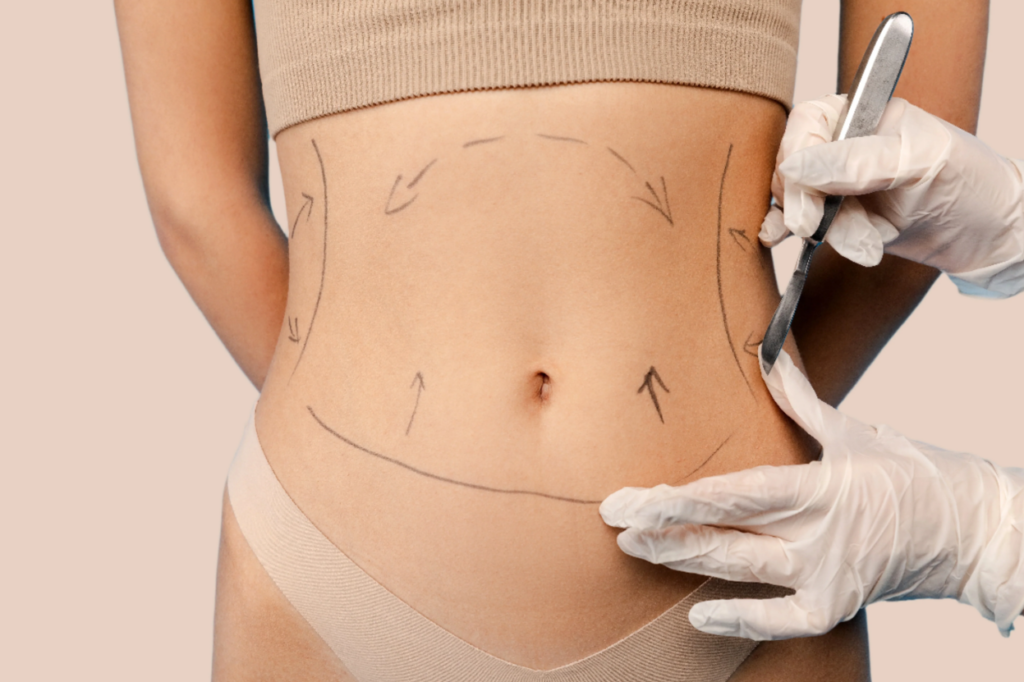 Abdomen & Waist Liposuction Surgery