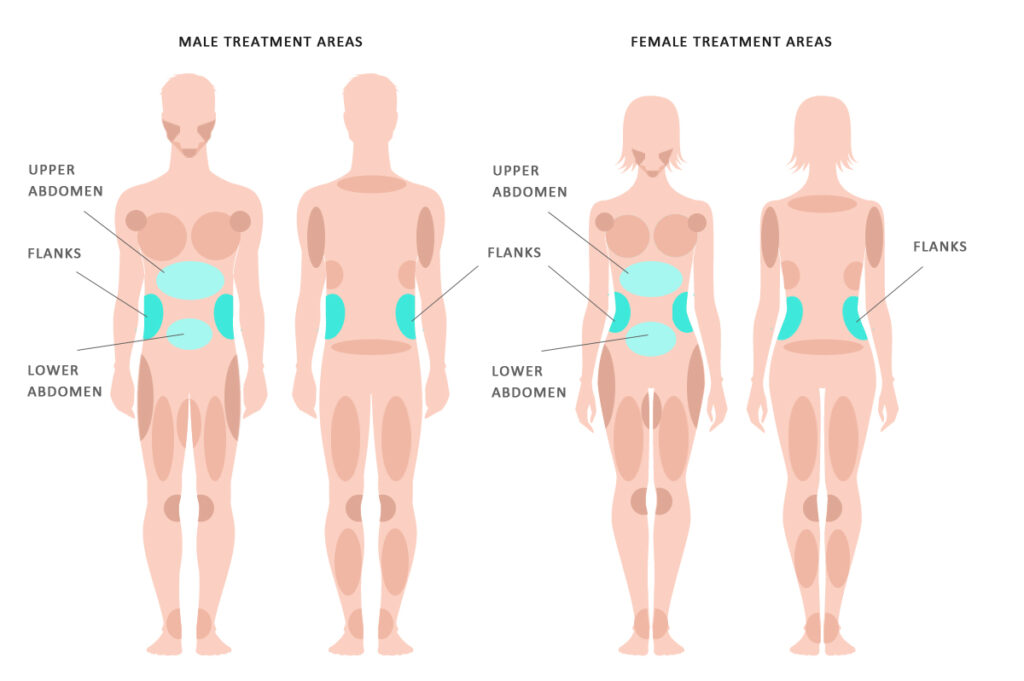 Back & Flank Fat Removal